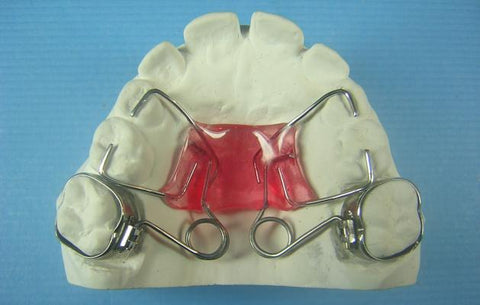 Pendulum Distalizer Orthodontic Model