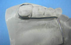 E Arch Expansion Orthodontic Model