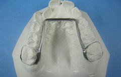 E Arch Expansion Orthodontic Model