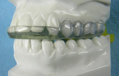 Goldilocks Splint Orthodontic appliabce Model