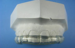 Hard Splints Orthodontic retainer Model