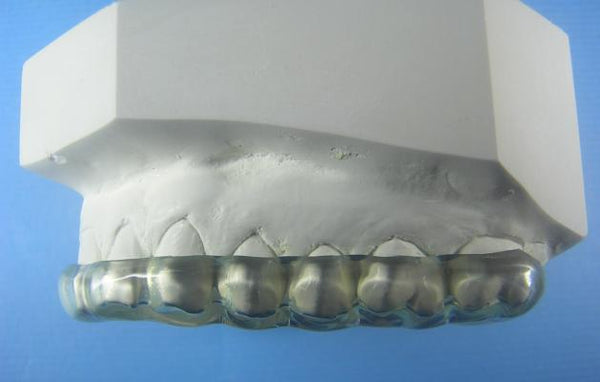 Hard Splints Orthodontic Model