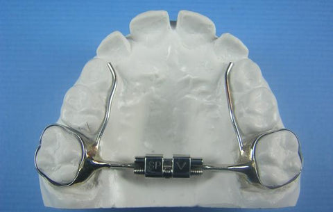 Mini Screw Expansion Orthodontic appliance Model