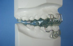 Teuscher Activator Orthodontic Model