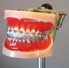 orthodontic manikin