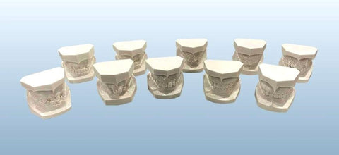 orthodontic malocclusion models set 