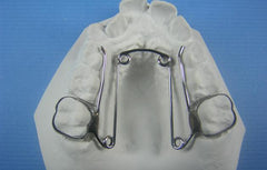 Quad Helix Rapid orthodontic model