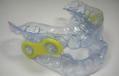 Obstructive Sleep Apnea Retainers Orthodontic Model