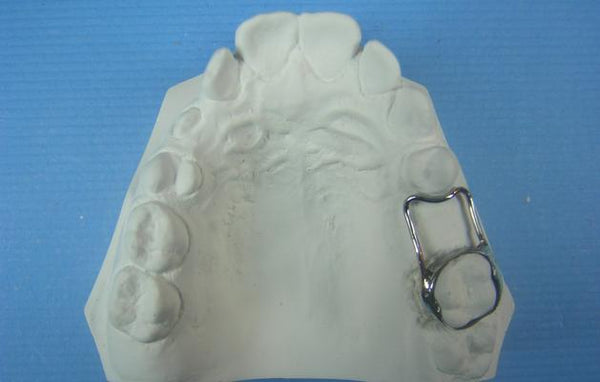 Space Maintainer Orthodontic Model