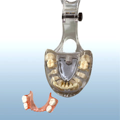 orthodontic teeth space maintenance model