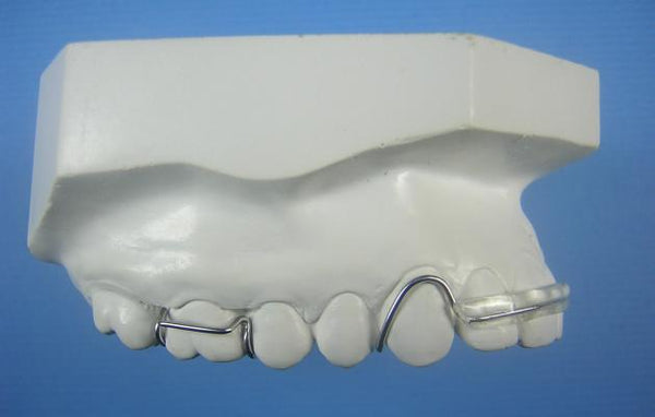 Modified Spring Retainer Orthodontic Model: Buyamag – Buyamag INC