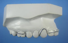 Spring Retainer Orthodontic Model