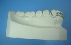 Modified Spring Retainer Orthodontic Model +2