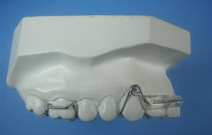 Modified Spring Retainer Orthodontic Model