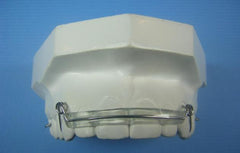 Modified Spring Retainer Orthodontic Model +2