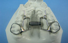 orthodontic super screw expander model