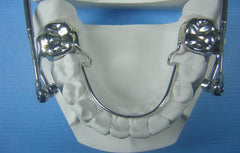 Herbst Orthodontic Model