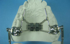 Herbst Telescoping Orthodontic Model