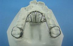 Thumb Habit Orthodontic Model