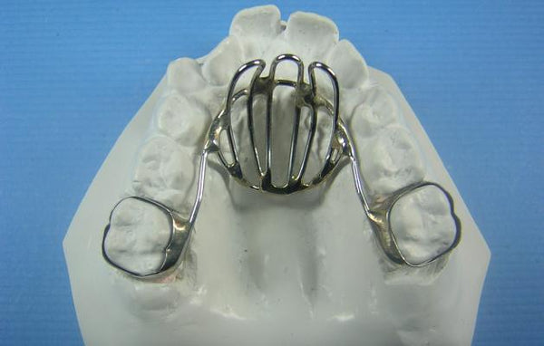 Tongue Habit Orthodontic Model