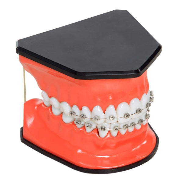 Orthodontic Tooth Brushing Model