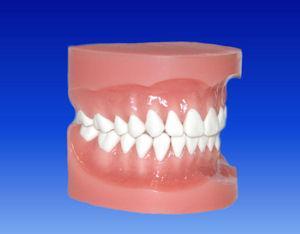 Orthodontic Bonding Model