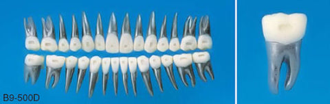 orthodontic metal teeth