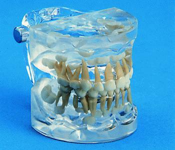primery dentition orthodontic model