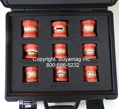 orthodontic malocclusion models 