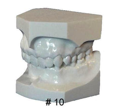 Orthodontic Malocclusion Set Of 10