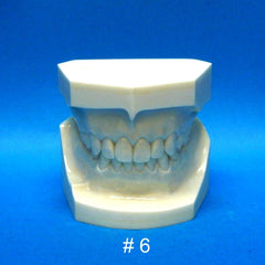 orthodontic malocclusion models 