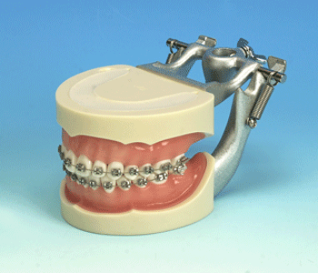 orthodontic model typodont