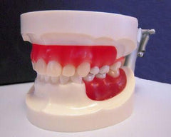 orthodontic model wax form
