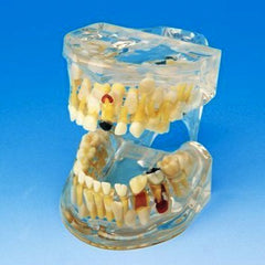 incisor eruption pathology model