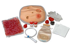 ostomy model