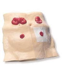 ostomy model