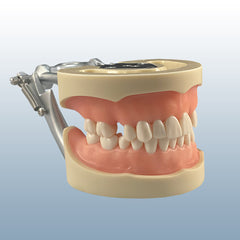 impression take edentulous model