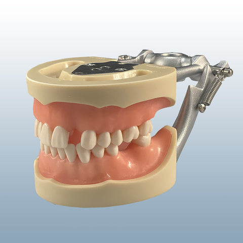 impression edentulous model