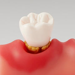 implant mucositis model