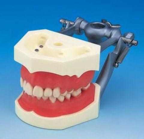 Periodontal Model