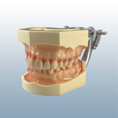 Periodontally Healthy Bony Affected Bone Resorption Model