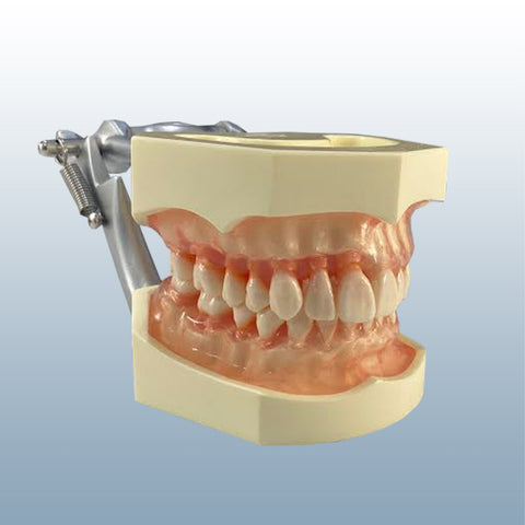 Periodontally Healthy Bony Affected Bone Resorption Model