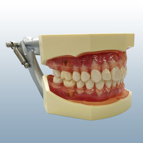 Periodontal Hygiene Model Calibration Detection Probing