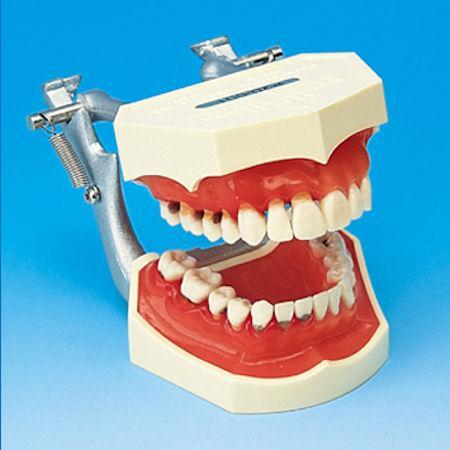 periodontal gum model