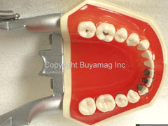periodontal abresion Model