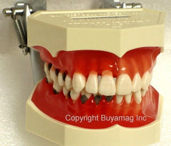 periodontal disease Model