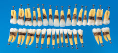 Replacement Teeth-hygiene