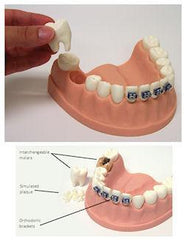 Dental Periodontal Orthodontic Hygiene Involved Model  Flossing & Brushing