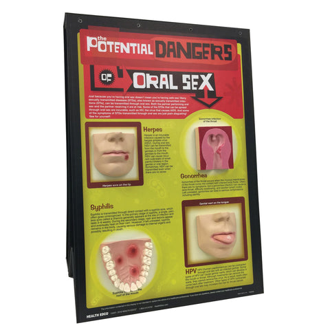 oral sex diseases model display