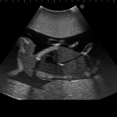 pregnancy ultrasound exam manikin